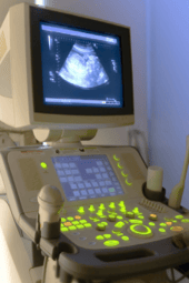 mog-ultrasound-1